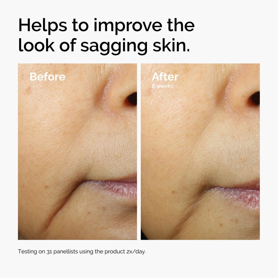caffeine-3-escin-1-face-serum-a1 ord-caffeine-3pct-escin-1pct-face-serum-before-after-sagging.jpg