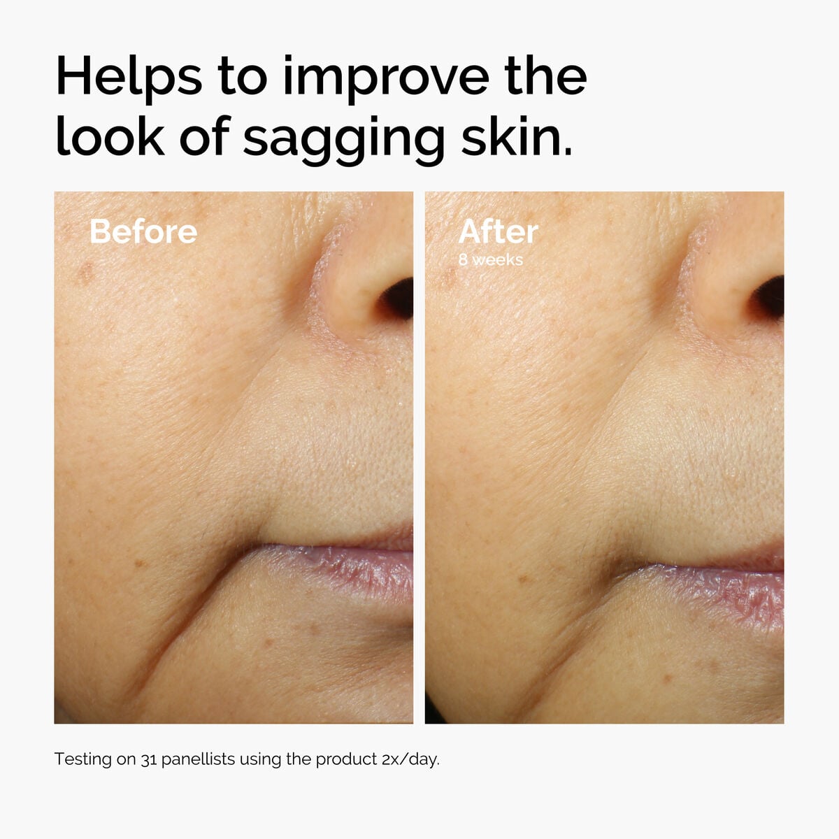 caffeine-3-escin-1-face-serum-a1 ord-caffeine-3pct-escin-1pct-face-serum-before-after-sagging.jpg