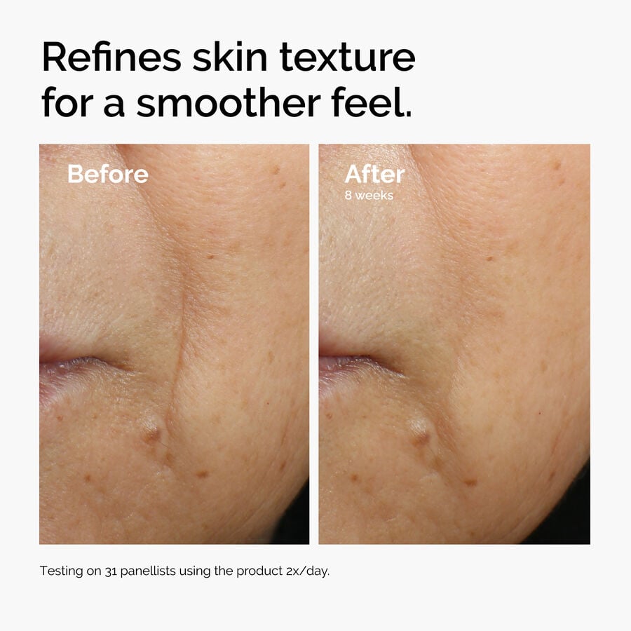 caffeine-3-escin-1-face-serum-a1 ord-caffeine-3pct-escin-1pct-face-serum-before-after-texture.jpg