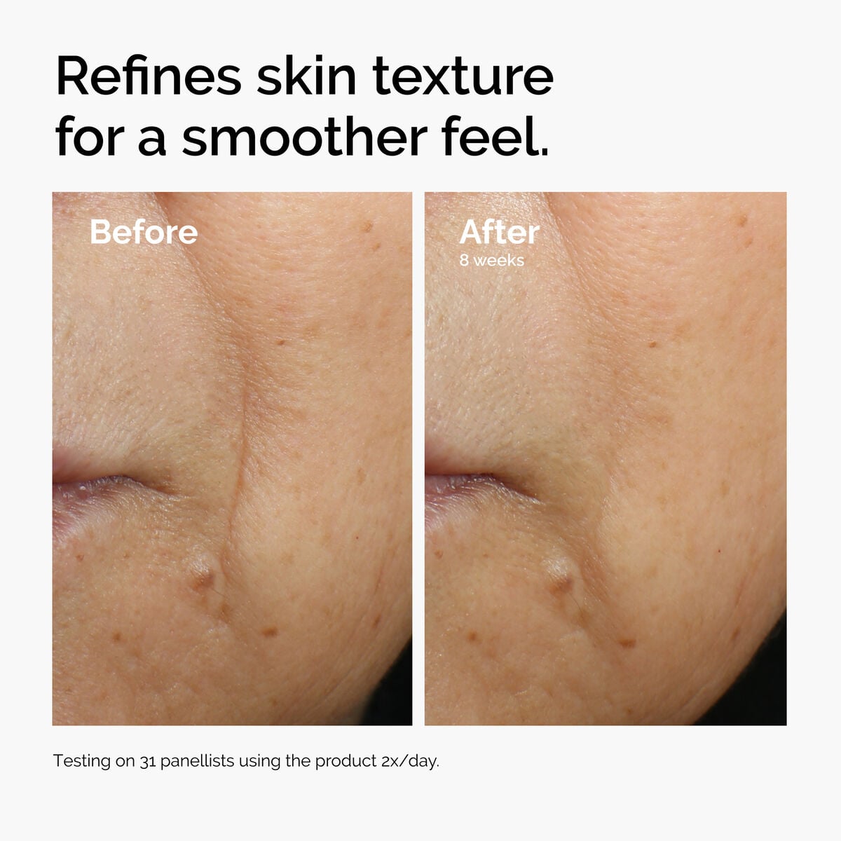 caffeine-3-escin-1-face-serum-a1 ord-caffeine-3pct-escin-1pct-face-serum-before-after-texture.jpg