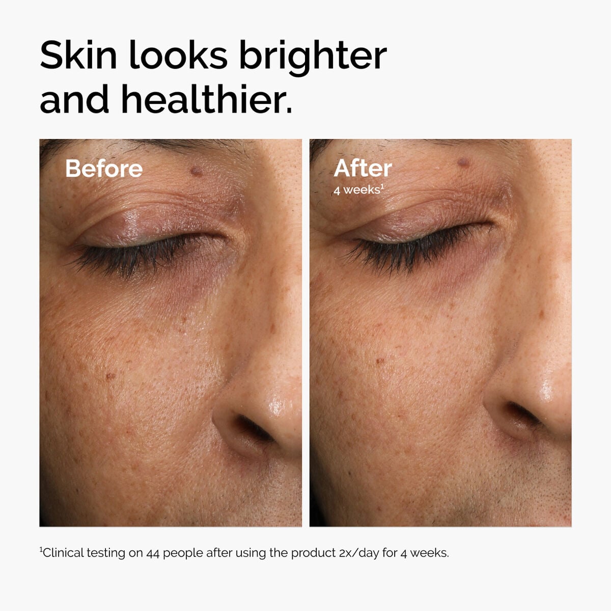 multi-antioxidant-radiance-serum-w6 ord-mars-before-after-healthy.jpg