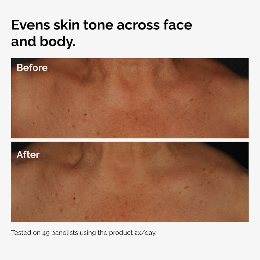 the-body-care-collection-w5 ord-niacinamide-face-body-serum-before-after-even-tone-graphic.jpg
