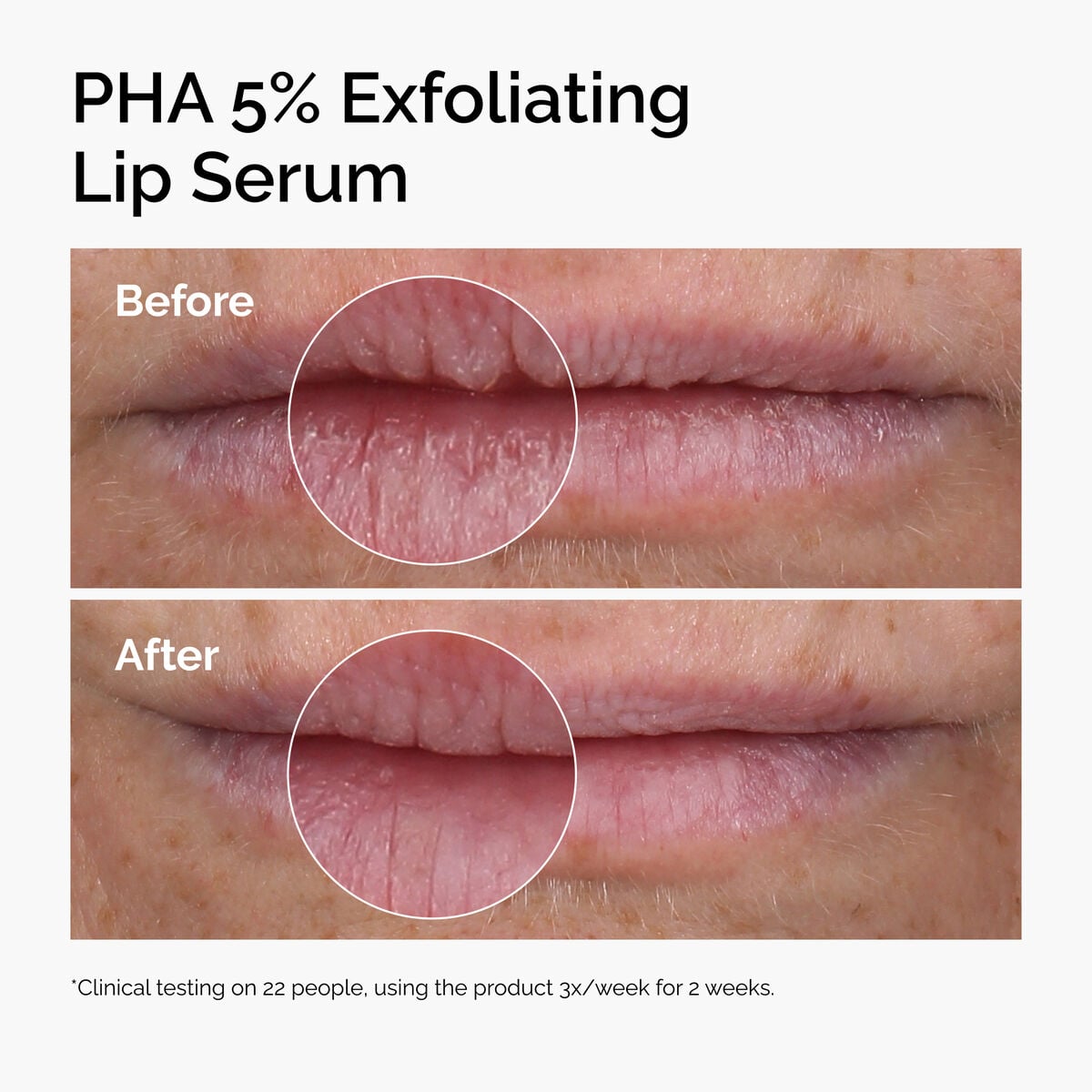 pha-5-exfoliating-lip-serum-t0 ord-pha-5pct-lip-exfoliating-serum-before-after.jpg