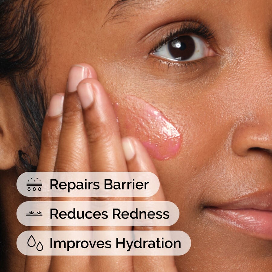 soothing-and-barrier-support-serum-f2 ord-soothing-barrier-support-serum-model-application-with-benefits.jpg